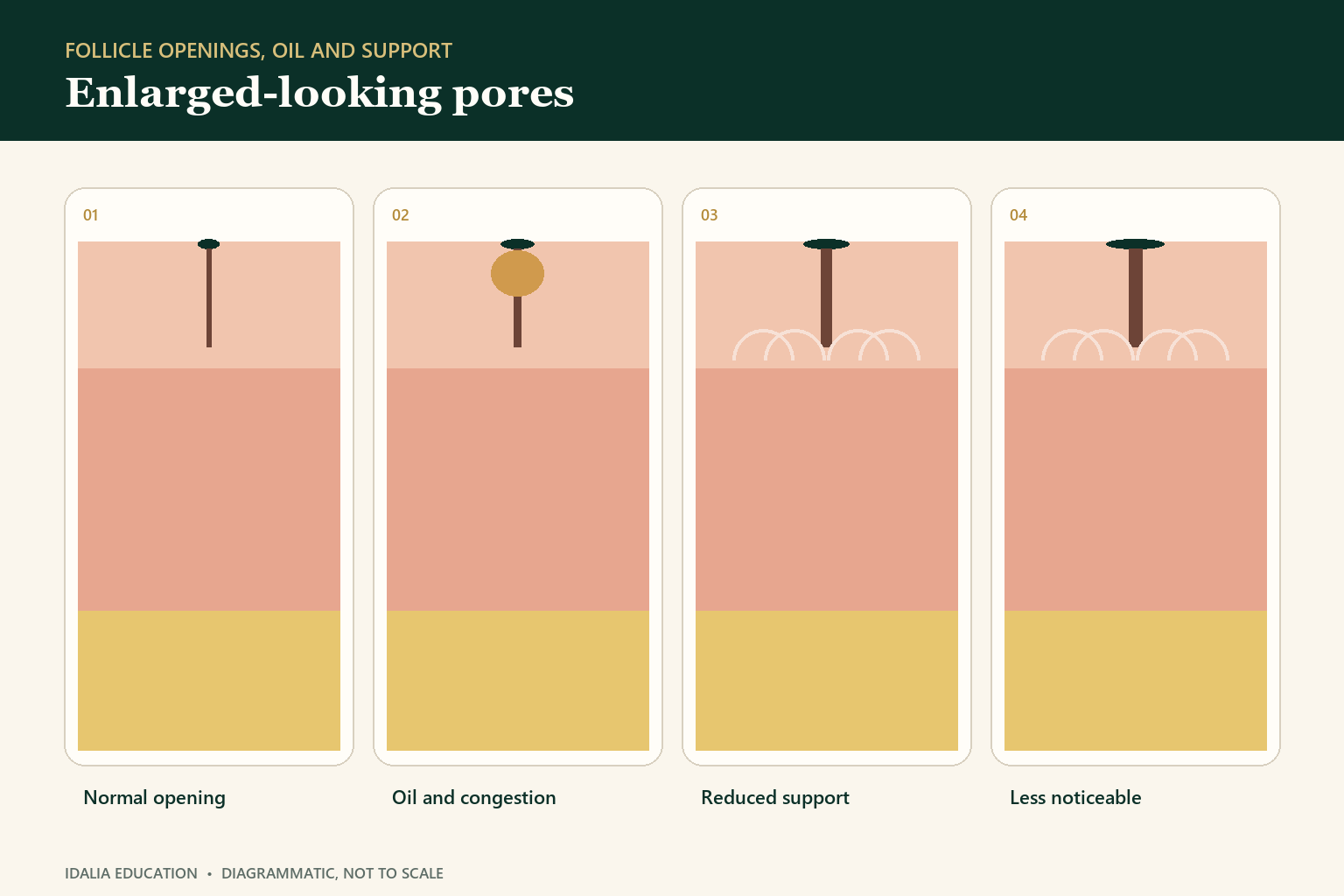Enlarged-looking pores