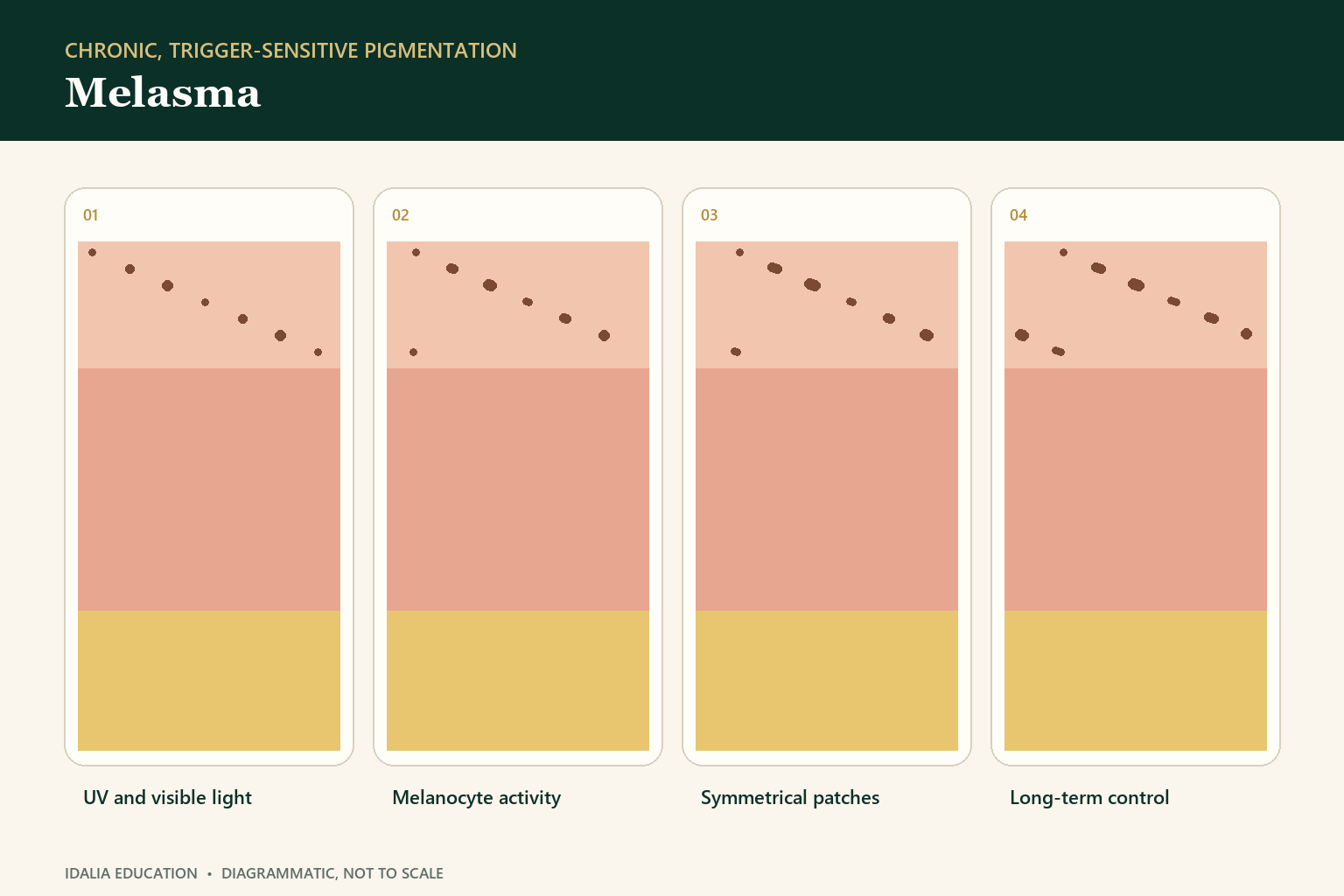 Four-part Idalia educational diagram explaining melasma