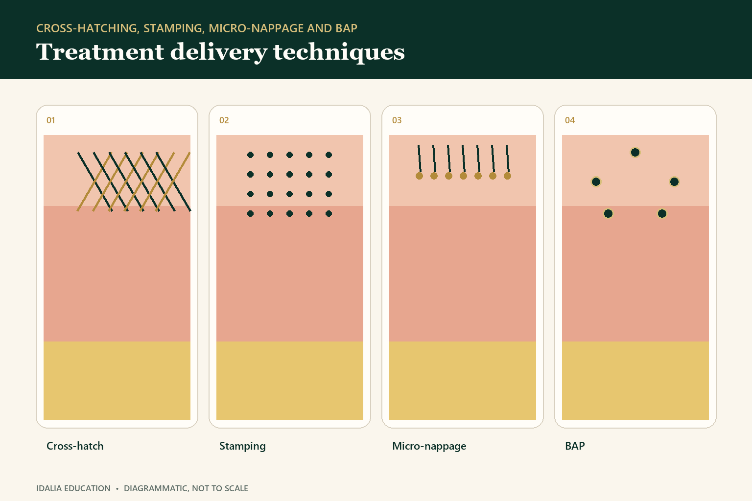 Treatment delivery techniques